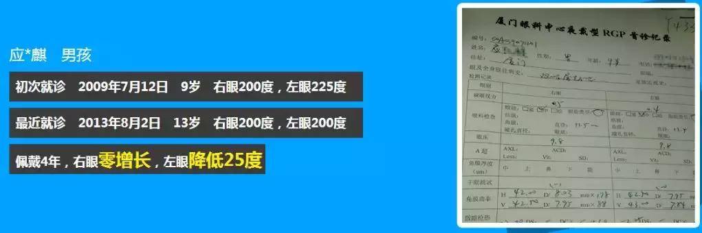 角膜塑形鏡